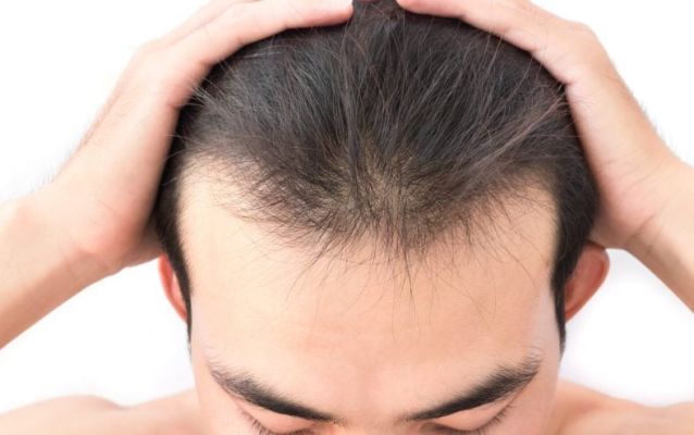 first signs of hair thinning