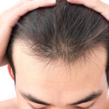 First Signs of Hair Thinning
